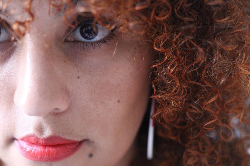 Erros que Pioram o Melasma