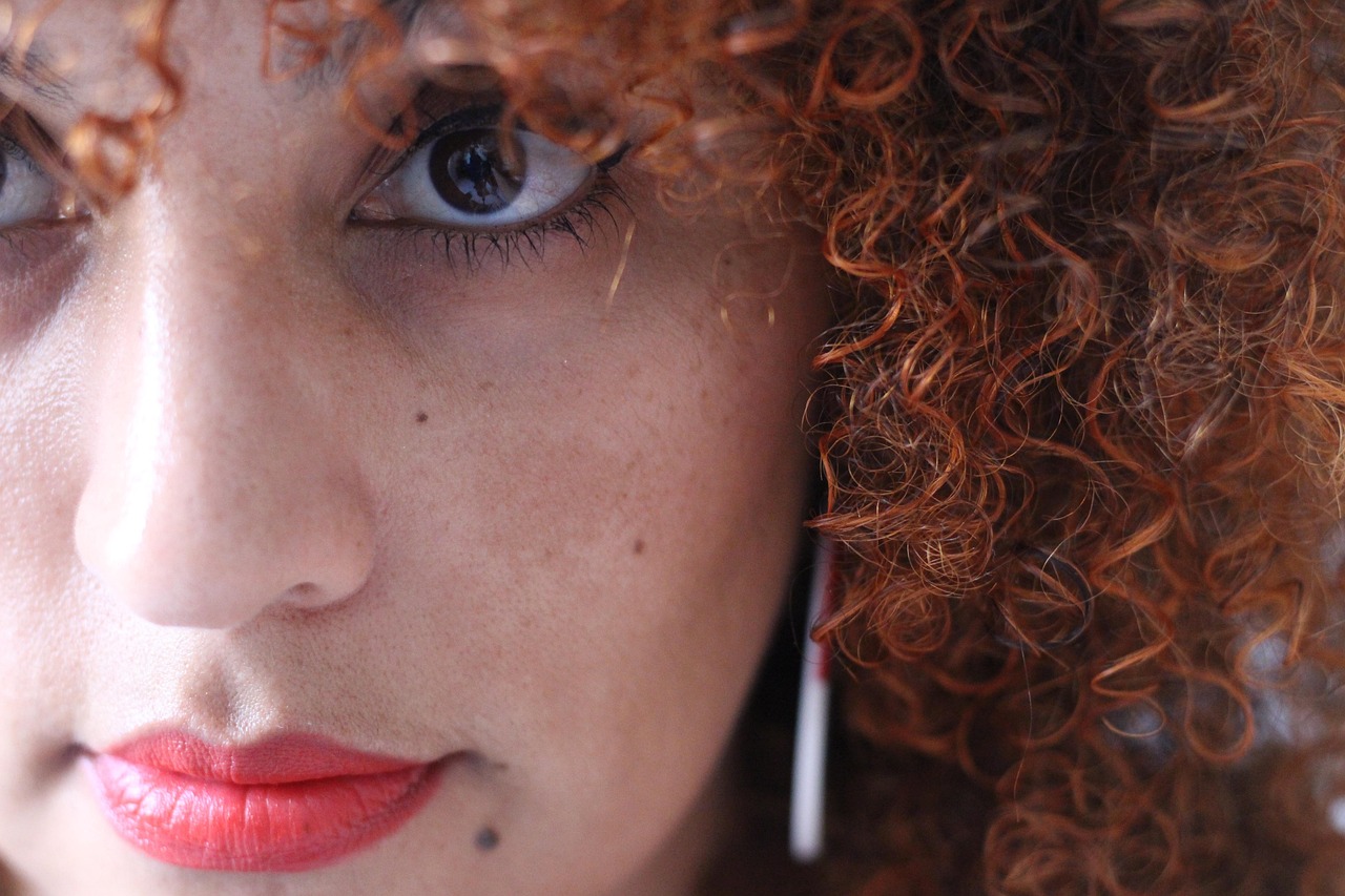 Erros que Pioram o Melasma: O que Evitar para Controlar as Manchas